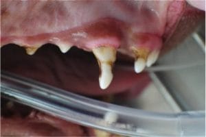 Malformation de l'émail