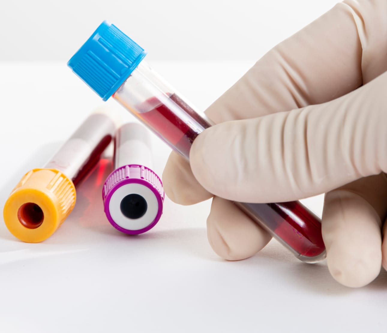 Flacon de sang pourr analyse vétérinaire