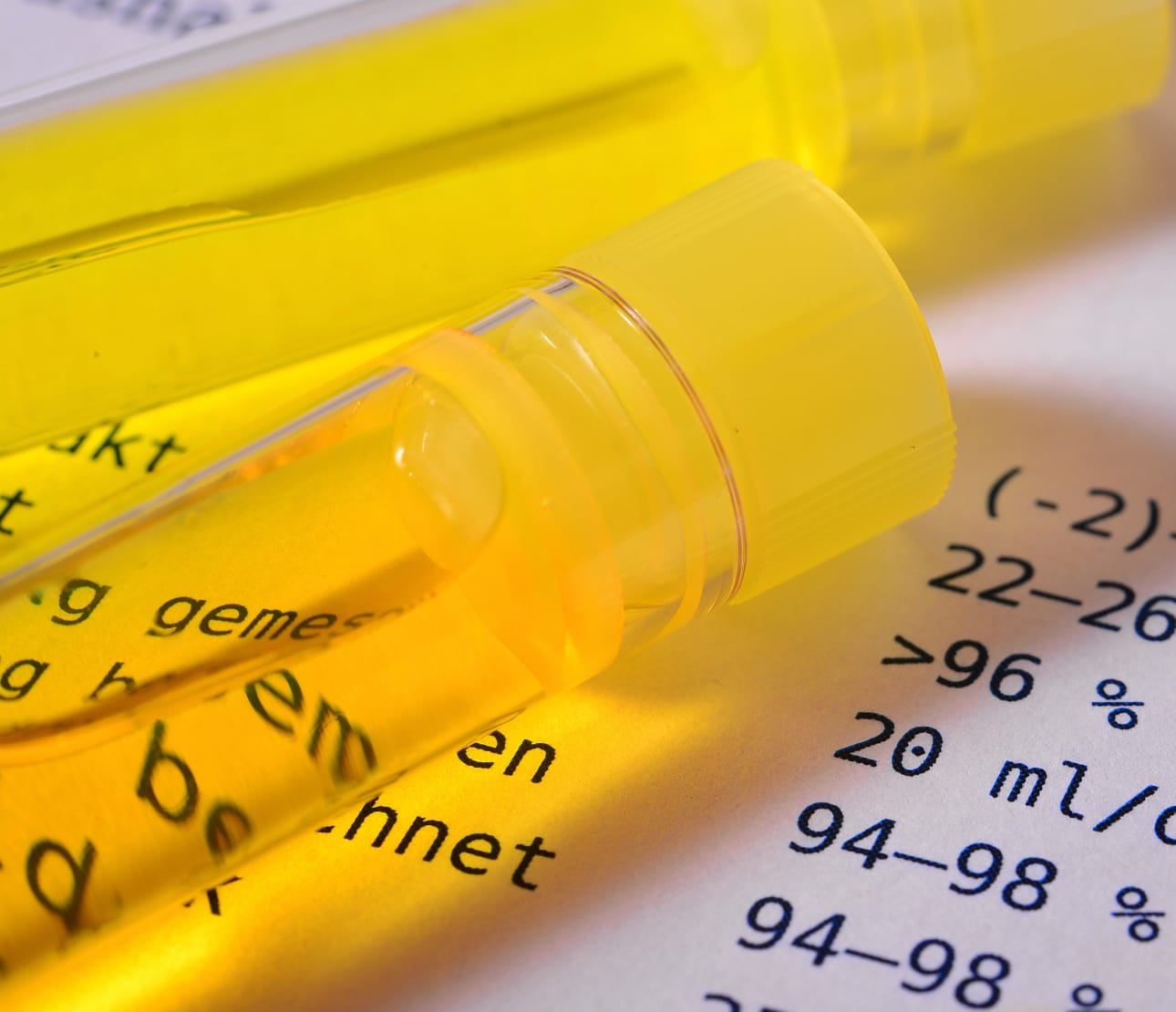 Flacon d'urine dans un laboratoire d'analyse vétérinaire
